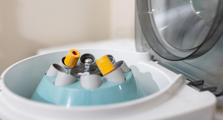 zblizenie-otwartej-wirowki-laboratoryjnej-z-probkami-wewnatrz-jednostek-obrotowych-uzywanych-do-oddzielania-cieczy-w-laboratorium-do-badan-medycznych-i-naukowych